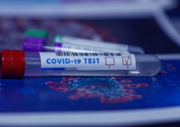 Odběrové místo na covid nově v budově C. V Pardubicích navýšena kapacita