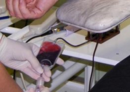 Informace o omezení odběrů krve a plazmy na HTO